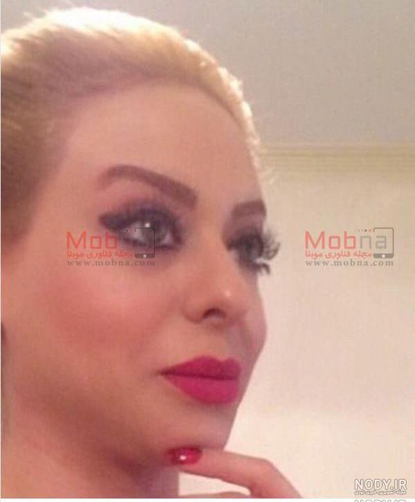 زهرا اویسی قبل از عمل زیبایی