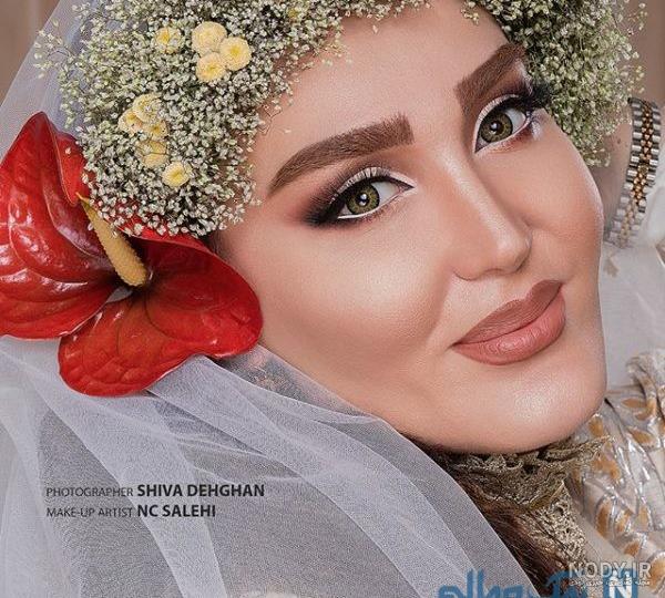 مریلا زارعی قبل از عمل بینی