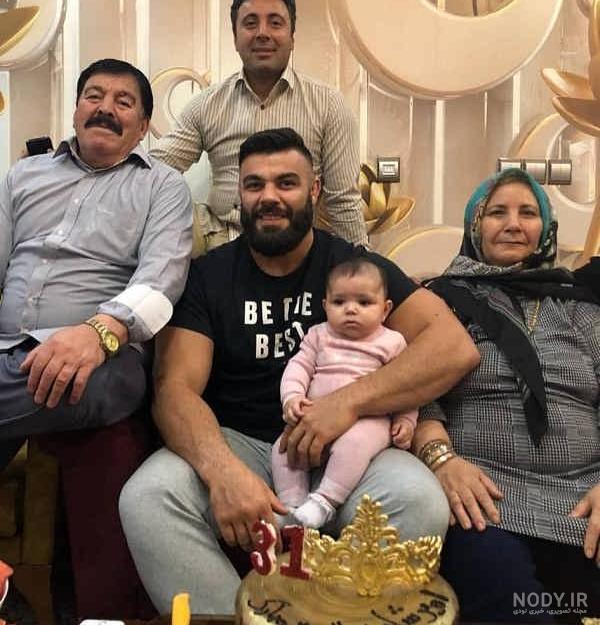 امیرعلی نبویان قبل از عمل بینی