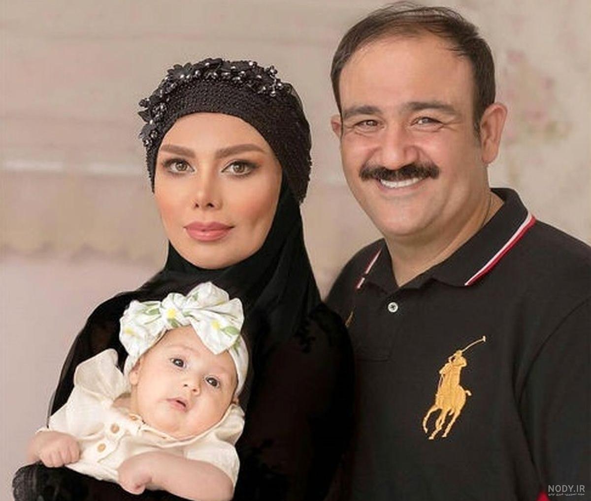 عکس مهران غفوریان بعد از عمل