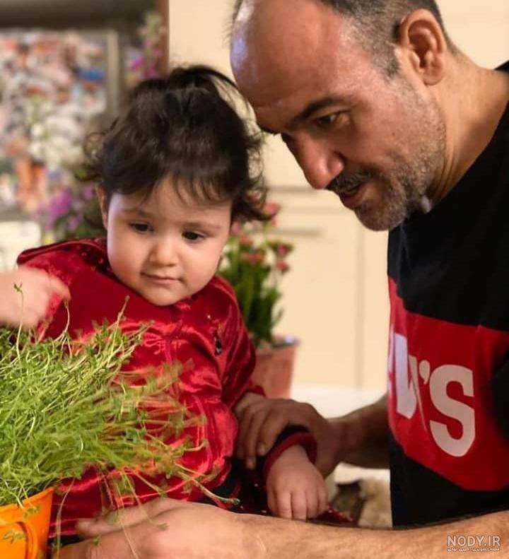 عکس مهران غفوریان بعد از عمل