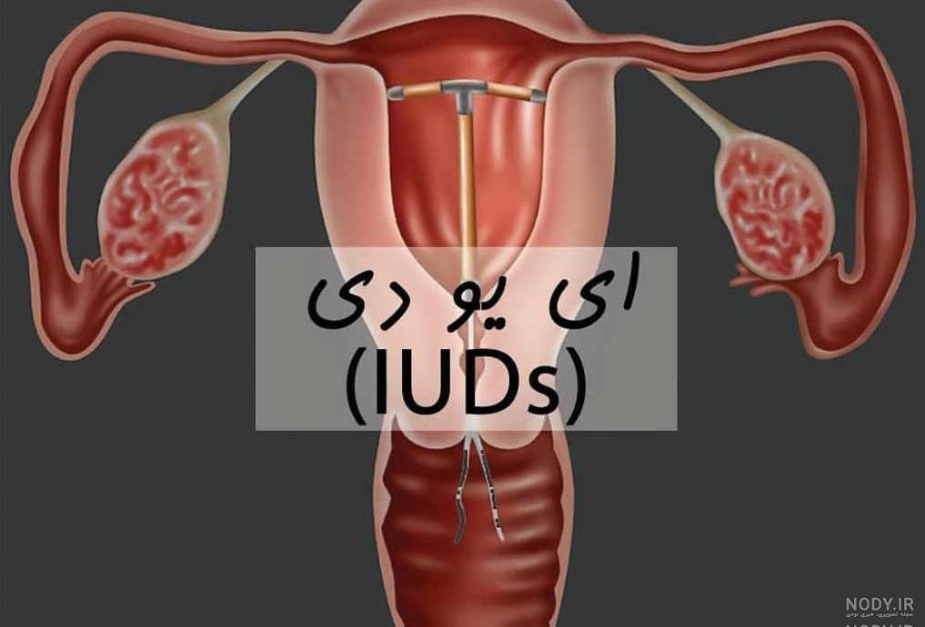 زود بزرگ شدن شکم و جنسیت جنین زود بزرگ شدن شکم و جنسیت جنین