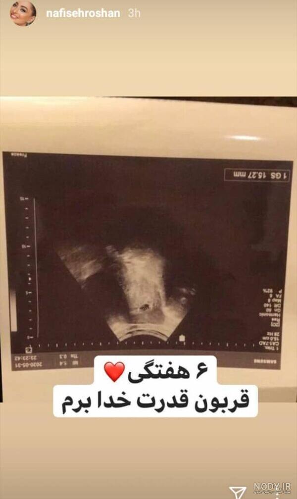 عکس بچه های شبنم تووزلو عکس بچه های شبنم تووزلو