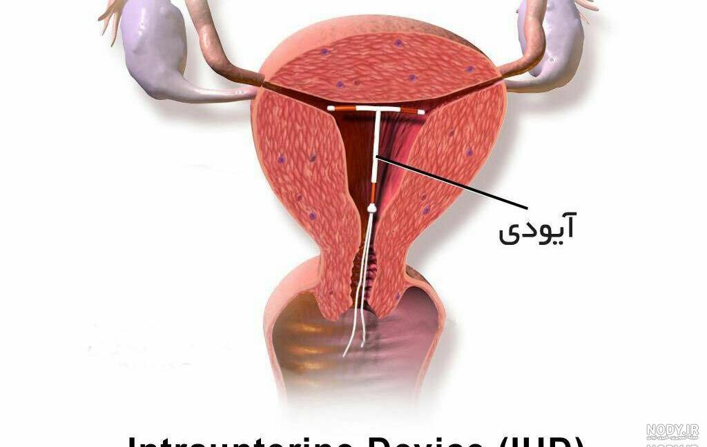 عکس قرص ضد بارداری اورژانسی عکس قرص ضد بارداری اورژانسی