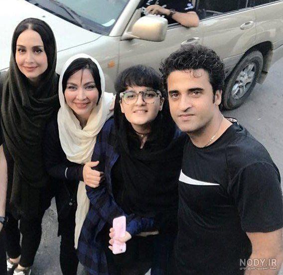 فقیهه سلطانی قبل از عمل فقیهه سلطانی قبل از عمل