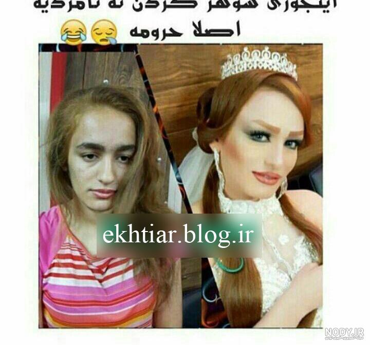 قبل و بعد آرایش کره ای قبل و بعد آرایش کره ای