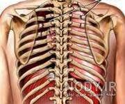 قیمت چسب شکستگی دنده قیمت چسب شکستگی دنده