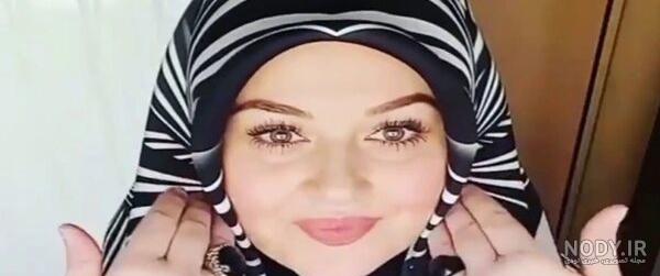 لاغری هانده ارچل لاغری هانده ارچل
