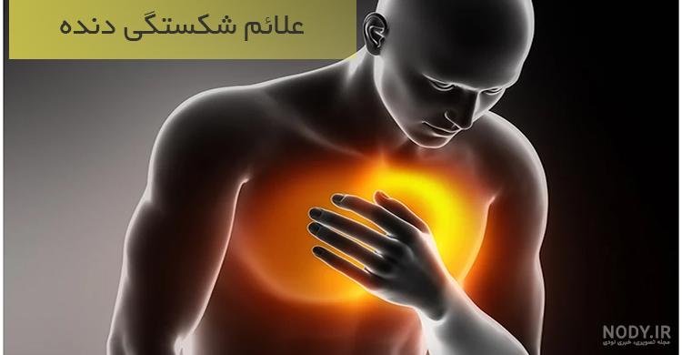 گرافی شکستگی دنده گرافی شکستگی دنده