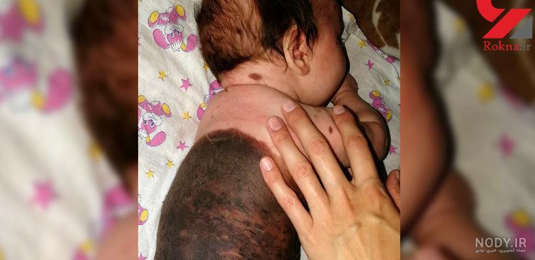 افسانه خال روی بدن افسانه خال روی بدن
