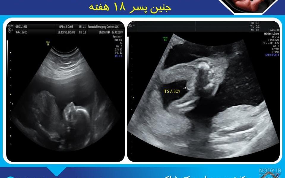 عکس جنین دوازده هفته دختر نی نی سایت عکس جنین دوازده هفته دختر نی نی سایت