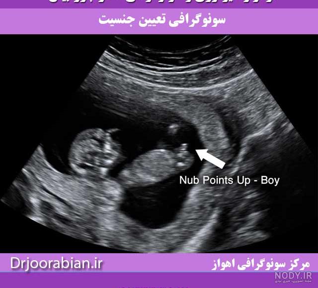 عکس جنین سه ماهه عکس جنین سه ماهه