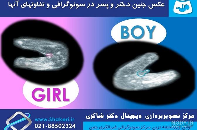 عکس جنین سه ماهه دختر عکس جنین سه ماهه دختر