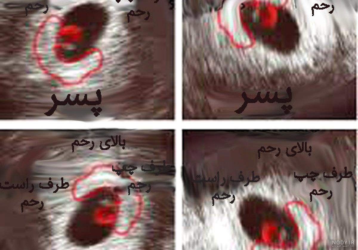 عکس دختر بچه سه ماهه عکس دختر بچه سه ماهه