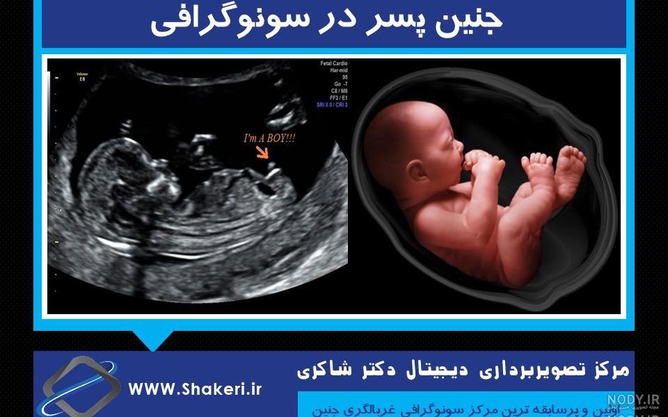 عکس سونوگرافی بارداری عکس سونوگرافی بارداری
