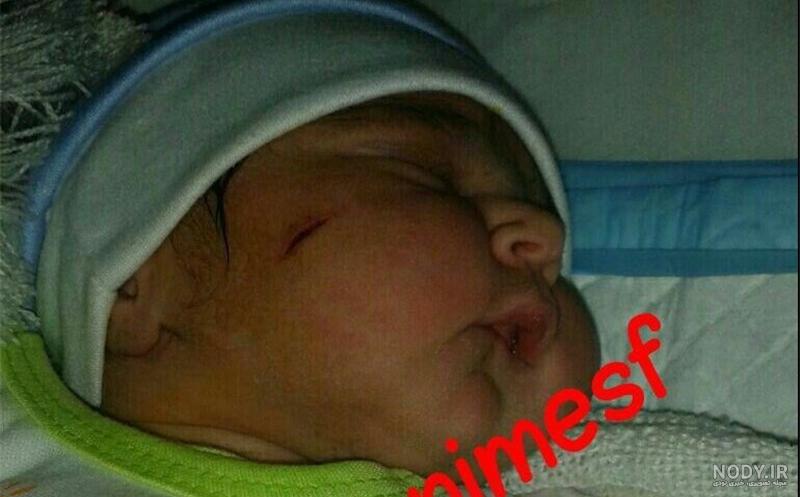 عکس نوزاد تازه متولد شده دختر زیبا عکس نوزاد تازه متولد شده دختر زیبا