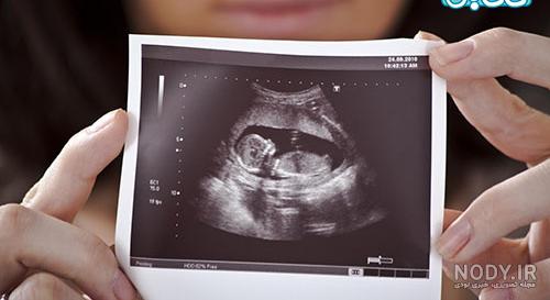 فیلم جنین سه ماهه دختر فیلم جنین سه ماهه دختر