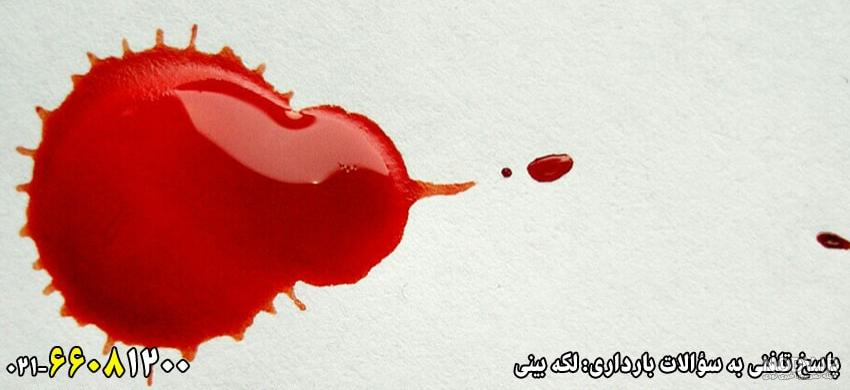 لکه بینی در بارداری تا چند روز طبیعی است نی نی سایت