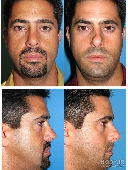 معیار های زیبایی جهانی معیار های زیبایی جهانی