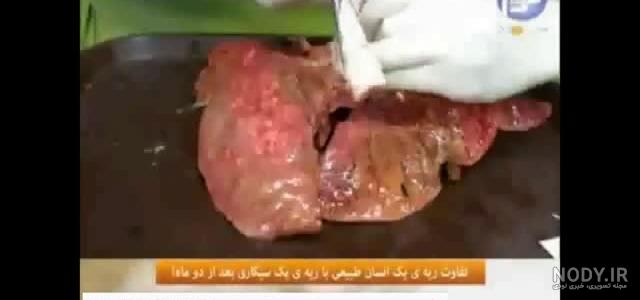 بخور برای پاکسازی ریه