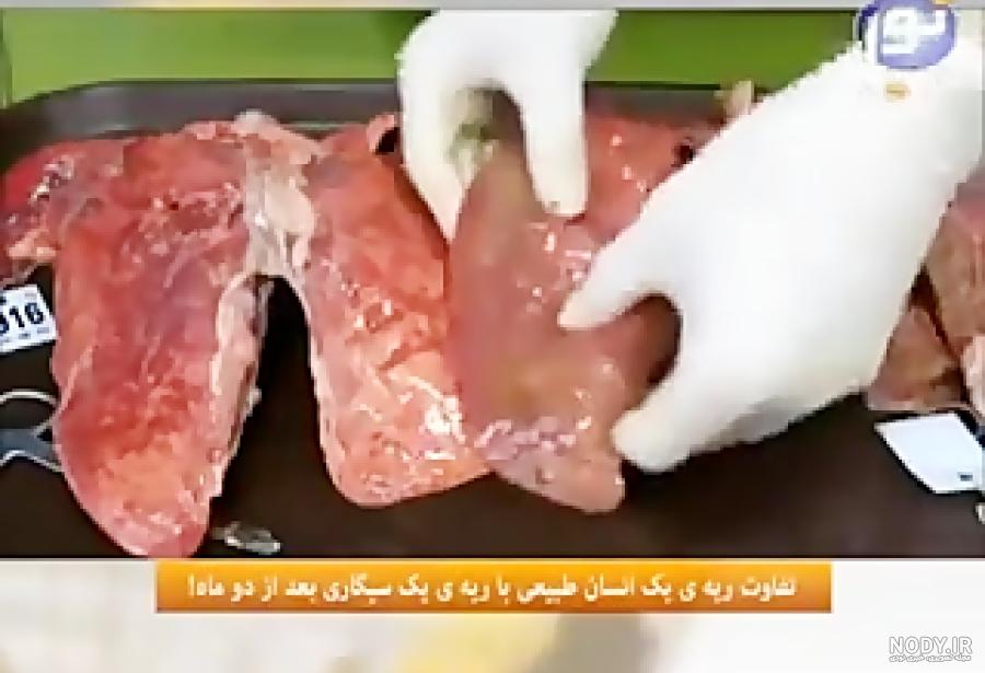 تفاوت ریه و شش
