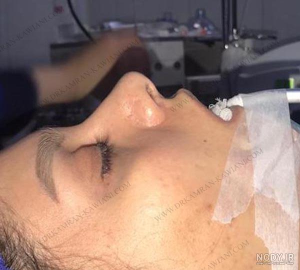دماغ نو مبارک دماغ نو مبارک
