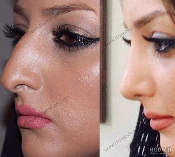 عکس کیک دماغ جدید مبارک عکس کیک دماغ جدید مبارک