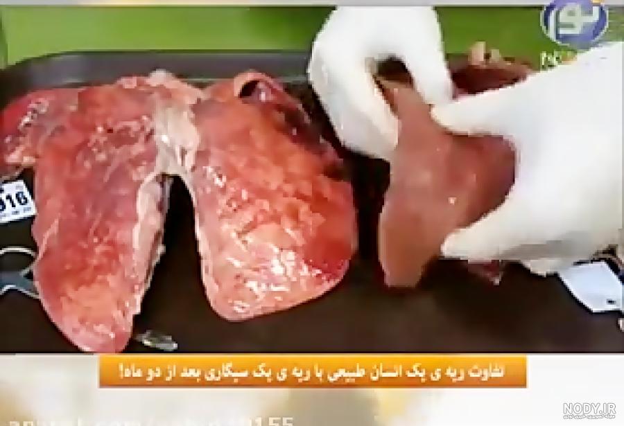 فیزیولوژی ریه