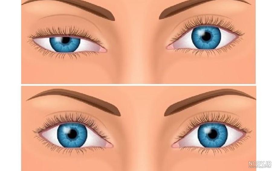 چشم ریز زیبا چشم ریز زیبا