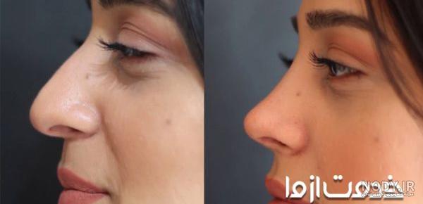 کیک عمل دماغ کیک عمل دماغ
