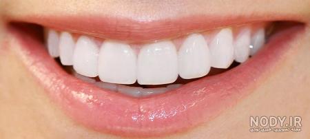 طرح لبخند نقاشی