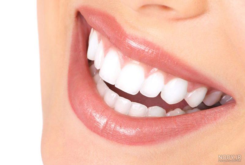 عوارض اصلاح طرح لبخند
