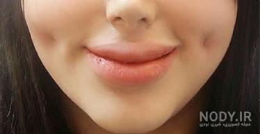 عکس دختر بچه چال گونه دار عکس دختر بچه چال گونه دار