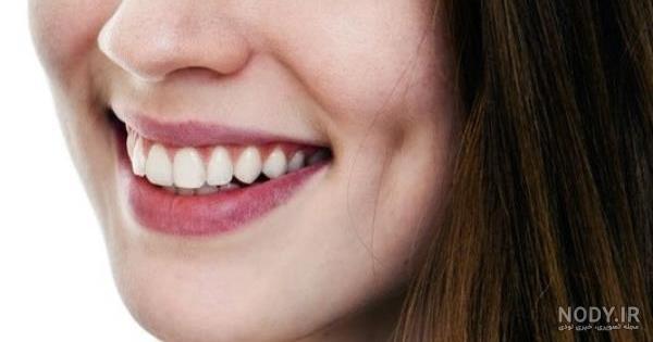 عکس دختر بچه چال گونه دار عکس دختر بچه چال گونه دار