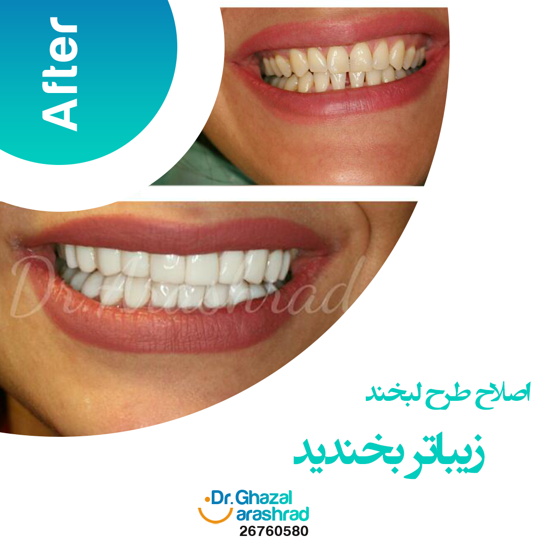 عکس طرح لبخند