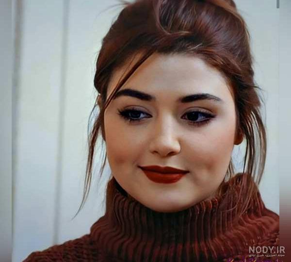 عکس چال گونه پسر عکس چال گونه پسر