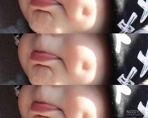 چال لپ جنین نی نی سایت چال لپ جنین نی نی سایت