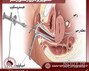 بهترین عکس رنگی رحم در مشهد