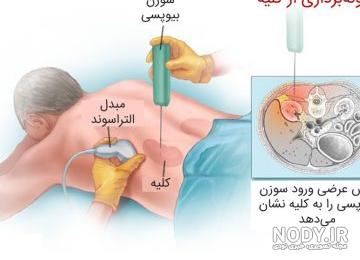 جواب عکس رنگی رحم