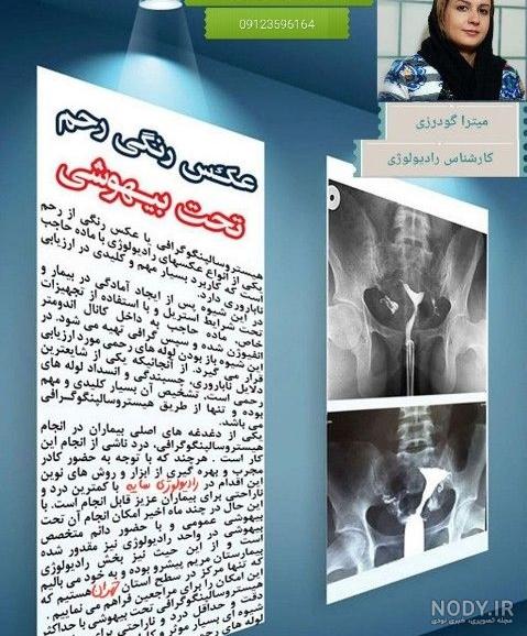 عکس رنگی رحم مشهد نی نی سایت