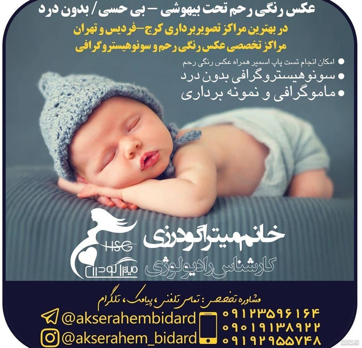 عکس رنگی رحم نی نی سایت