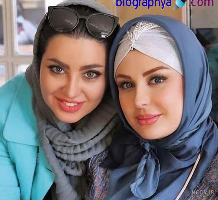 عکس نیوشا ضیغمی قبل از عمل