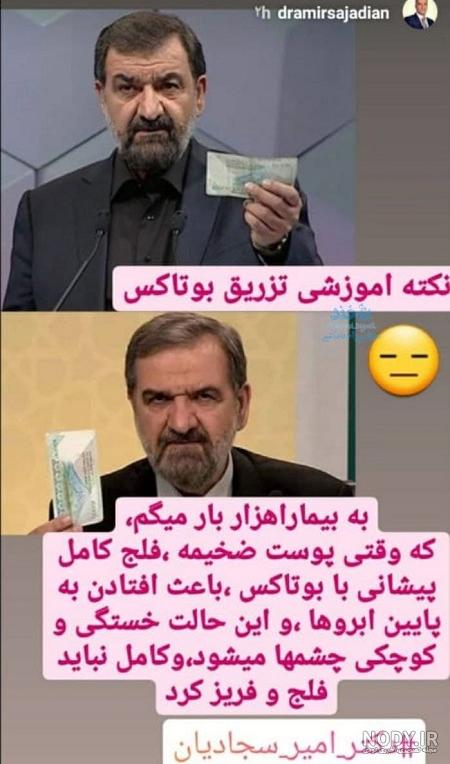 محسن رضایی قبل و بعد از بوتاکس