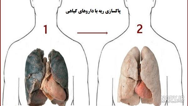 چرا افراد سیگاری زیاد سرفه میکنند علوم هفتم