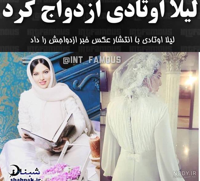 عکس لیلا اوتادی قبل از عمل