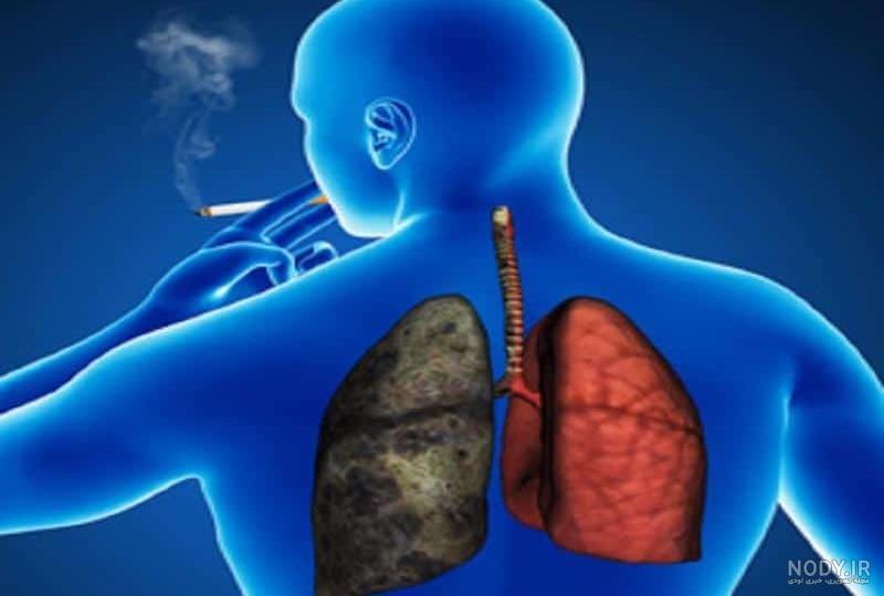 آثار فیزیولوژیک سیگار