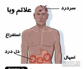 بیماری وبا واگیردار است بیماری وبا واگیردار است