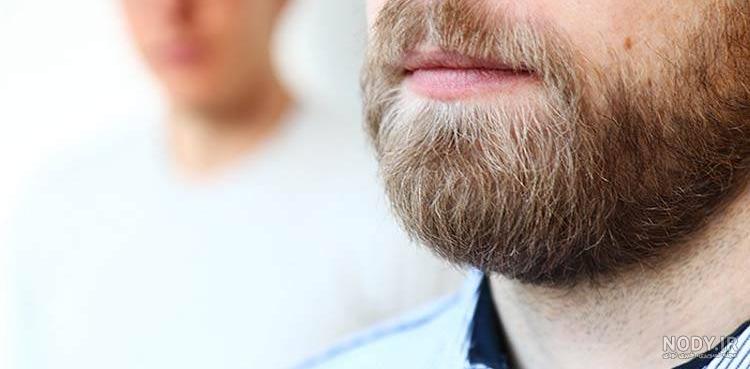 عوارض کاشت ریش عوارض کاشت ریش