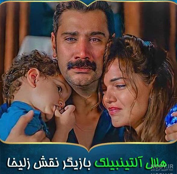 عکس قبل عمل هلال آلتینبیلک