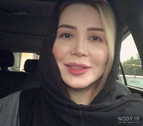 اخرین عکس سپیده هنرپیشه قدیمی اخرین عکس سپیده هنرپیشه قدیمی